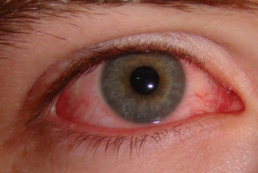 gritty-eyes